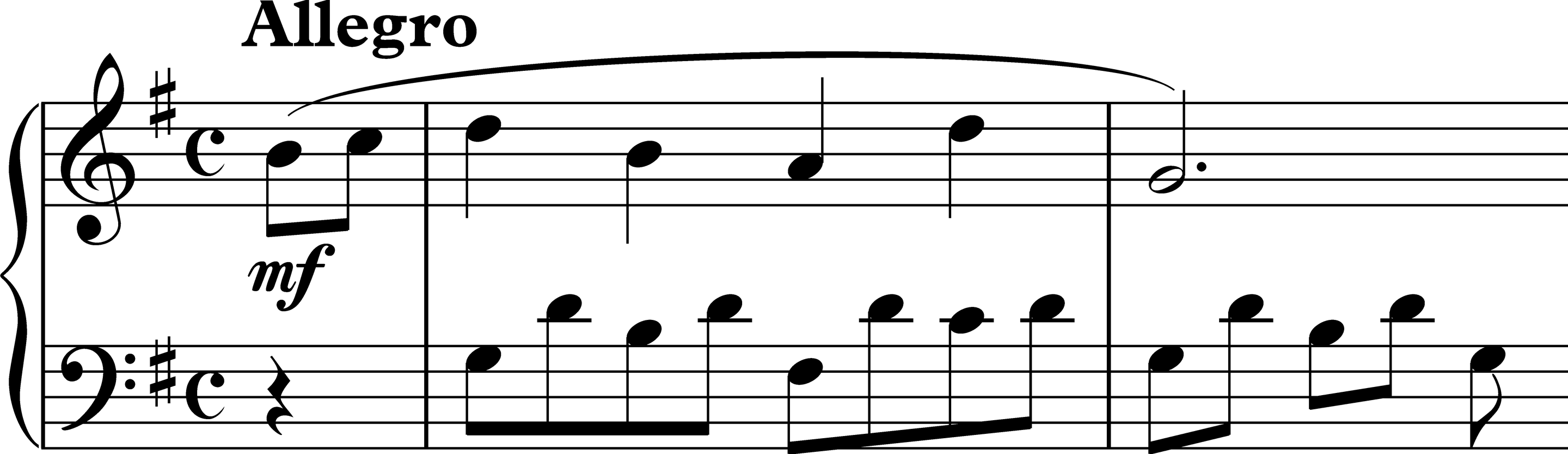 알베르티 베이스 (Alberti Bass; Basso albertino) BGSMM